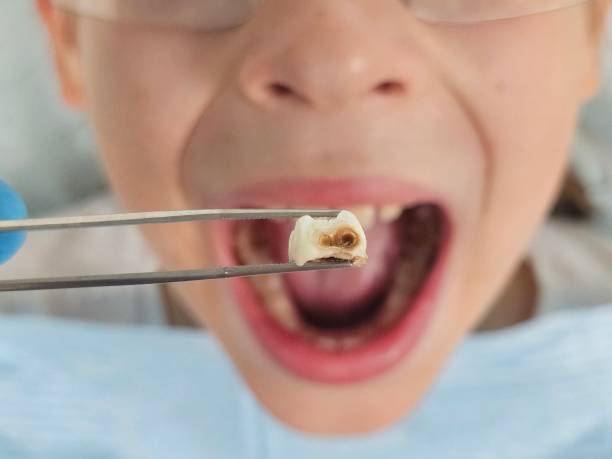 Best Emergency Care for Gum Disease in Mount Olive, AL